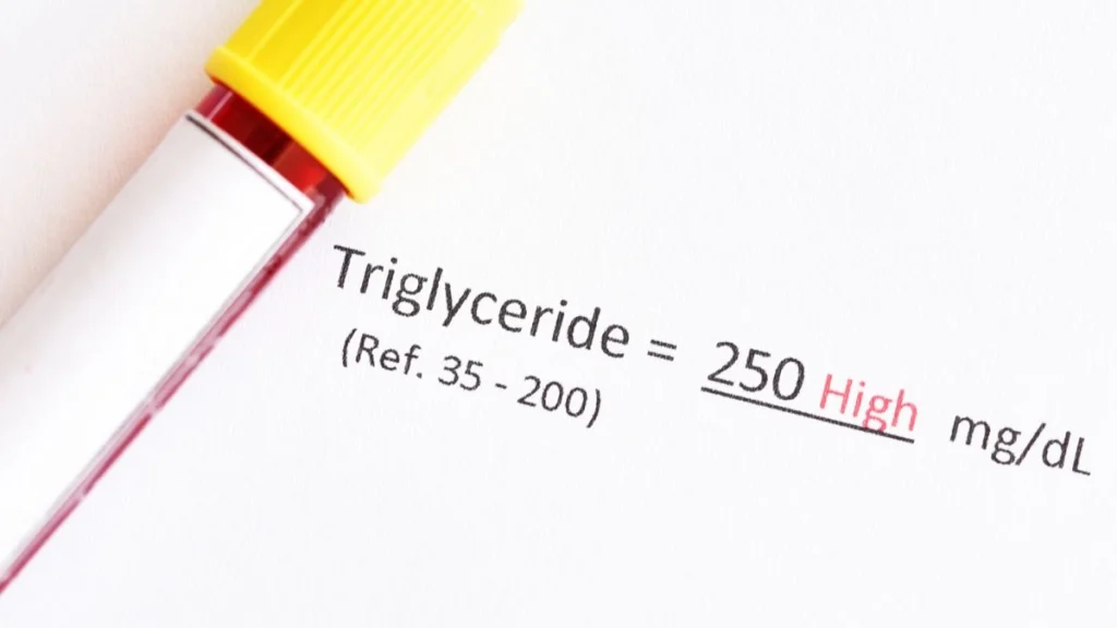 Your Lipid Profile Shows High Triglycerides and Low HDL