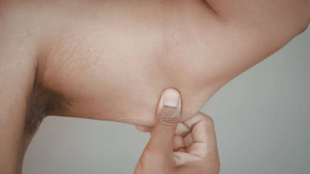 Odor Causing Bacteria Multiply Rapidly